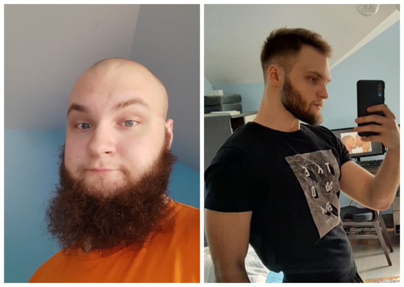 No más "patitos feos" : 22 fotos "antes y después" que te sorprenderán No más "patitos feos" : 22 fotos "antes y después" que te sorprenderán