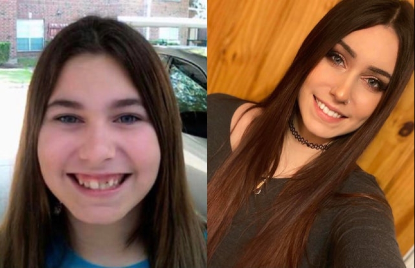 No más "patitos feos" : 22 fotos "antes y después" que te sorprenderán No más "patitos feos" : 22 fotos "antes y después" que te sorprenderán