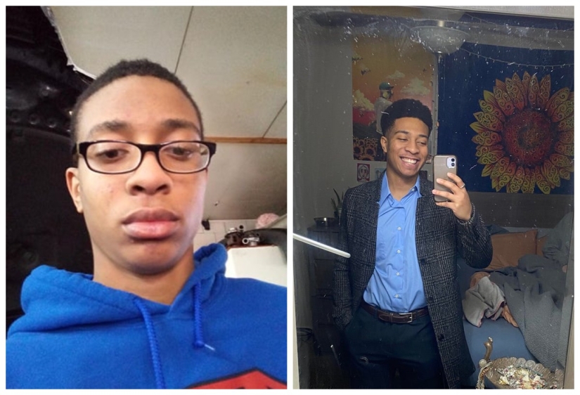 No más "patitos feos" : 22 fotos "antes y después" que te sorprenderán No más "patitos feos" : 22 fotos "antes y después" que te sorprenderán