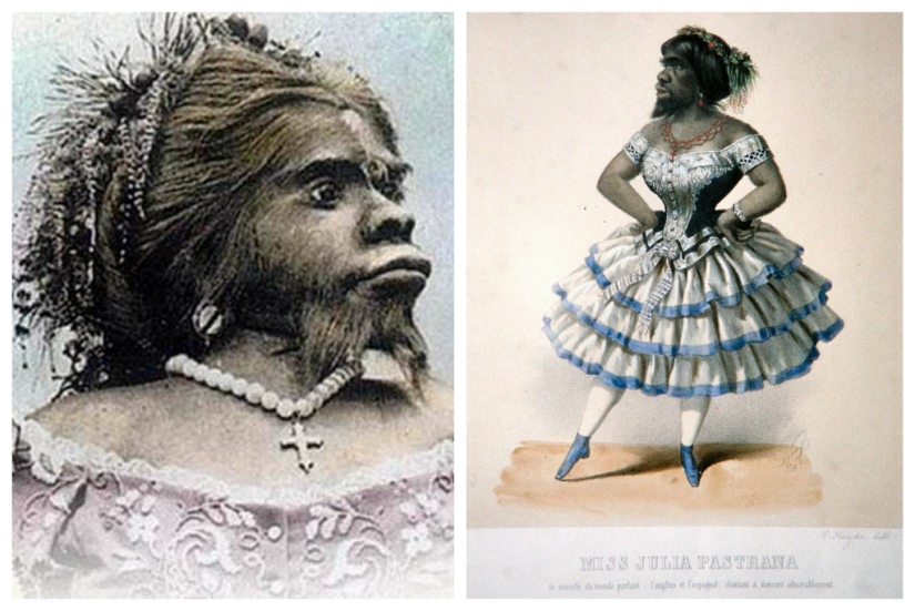 On the face of the terrible, kind inside: the life and death of bearded Julia, the ape woman from Mexico On the face of the terrible, kind inside: the life and death of bearded Julia, the ape woman from Mexico