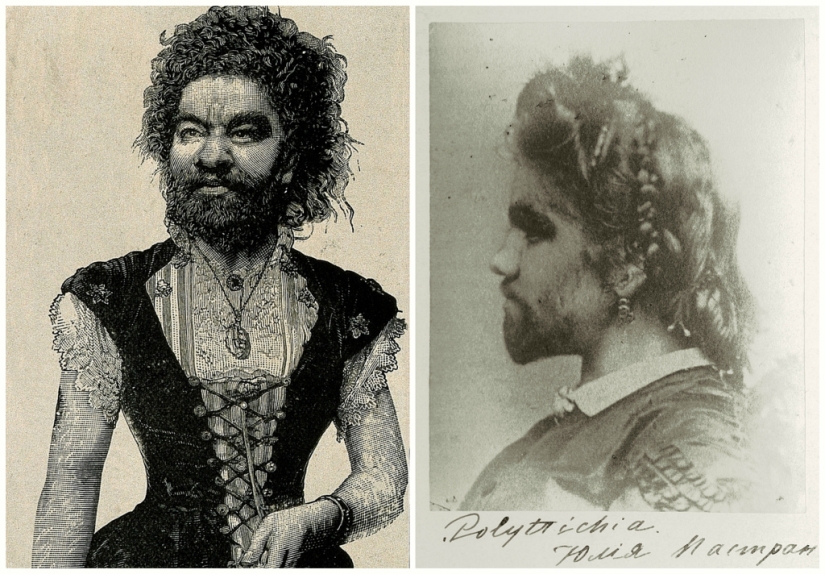 On the face of the terrible, kind inside: the life and death of bearded Julia, the ape woman from Mexico On the face of the terrible, kind inside: the life and death of bearded Julia, the ape woman from Mexico