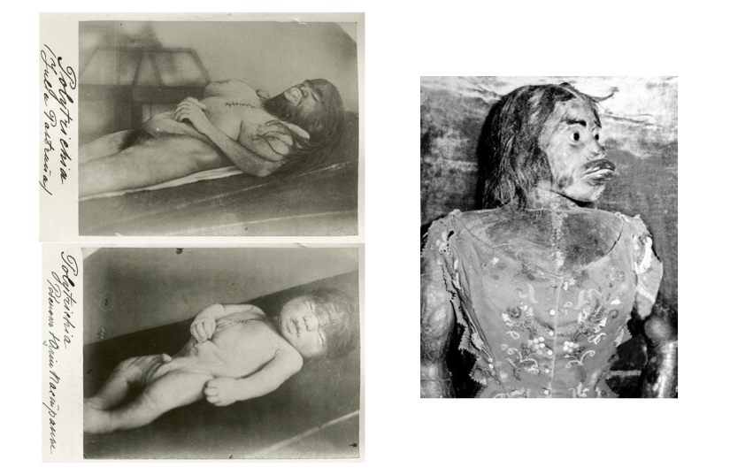 On the face of the terrible, kind inside: the life and death of bearded Julia, the ape woman from Mexico On the face of the terrible, kind inside: the life and death of bearded Julia, the ape woman from Mexico