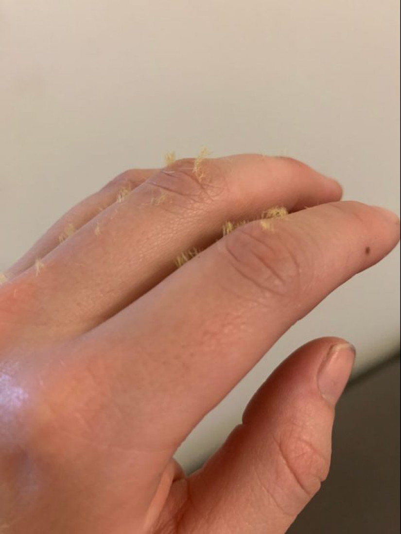 On the wrong foot: 20 photos of people whose day started not very well