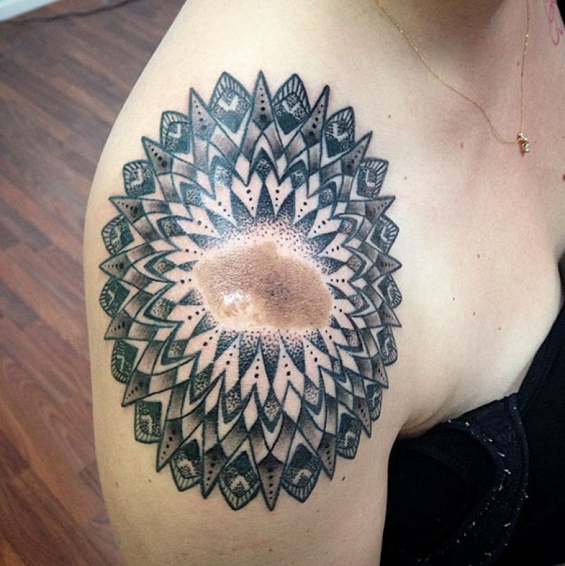 People with birthmarks who did not get confused and made them part of tattoos