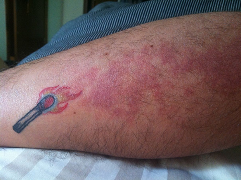 Personas con marcas de nacimiento que no se confundieron y las hicieron parte de los tatuajes Personas con marcas de nacimiento que no se confundieron y las hicieron parte de los tatuajes