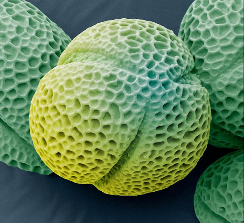 Pollen under a microscope