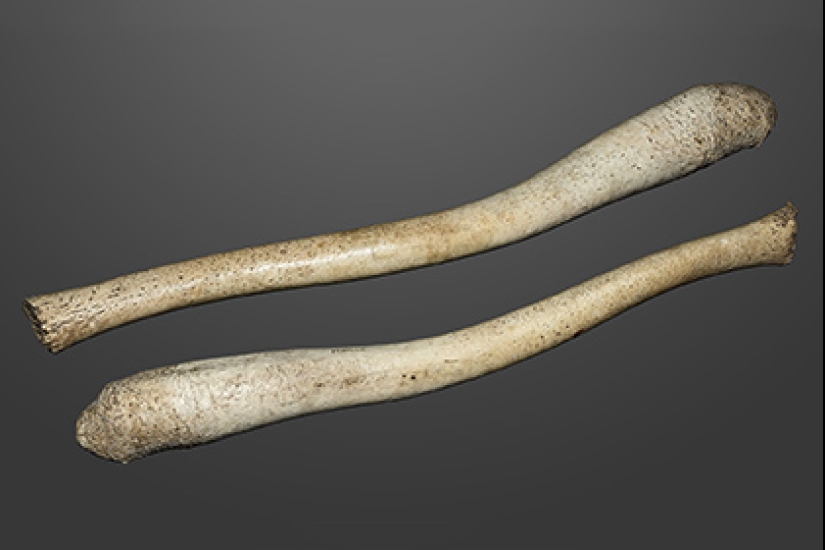 ¿Por qué el pene humano es tan pequeño y simple comparado con el pene de los animales?