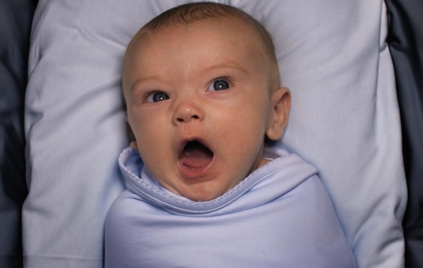 ¿Por qué es tan popular la circuncisión en los Estados Unidos? Y no se trata de higiene o religión en absoluto ¿Por qué es tan popular la circuncisión en los Estados Unidos? Y no se trata de higiene o religión en absoluto