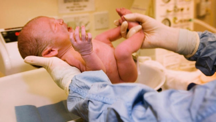 ¿Por qué es tan popular la circuncisión en los Estados Unidos? Y no se trata de higiene o religión en absoluto ¿Por qué es tan popular la circuncisión en los Estados Unidos? Y no se trata de higiene o religión en absoluto