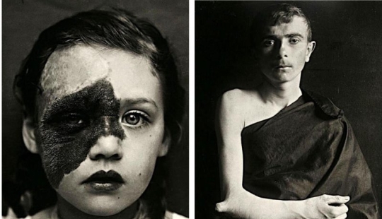 Portraits of pain: striking photographs of patients from nineteenth-century suffering from serious illnesses