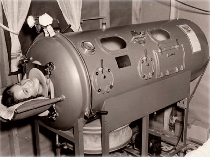 Prisoners of the "Iron lung": how to rescue victims of polio, have forgotten how to breathe Prisoners of the "Iron lung": how to rescue victims of polio, have forgotten how to breathe