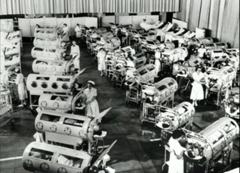 Prisoners of the "Iron lung": how to rescue victims of polio, have forgotten how to breathe Prisoners of the "Iron lung": how to rescue victims of polio, have forgotten how to breathe