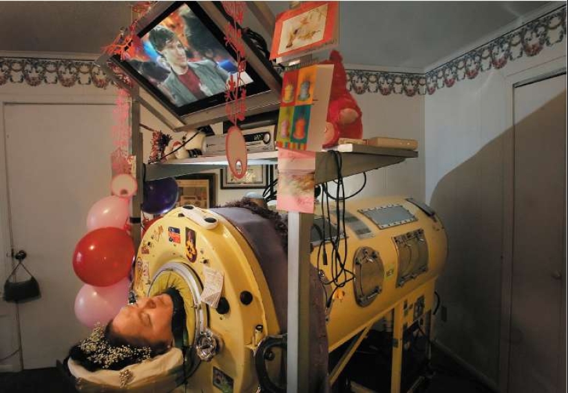 Prisoners of the "Iron lung": how to rescue victims of polio, have forgotten how to breathe Prisoners of the "Iron lung": how to rescue victims of polio, have forgotten how to breathe