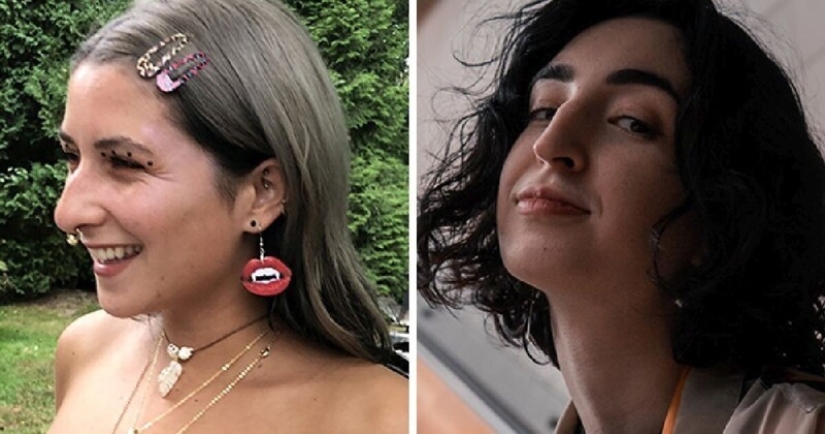 Proud profile: 30 imperfect but unique female noses