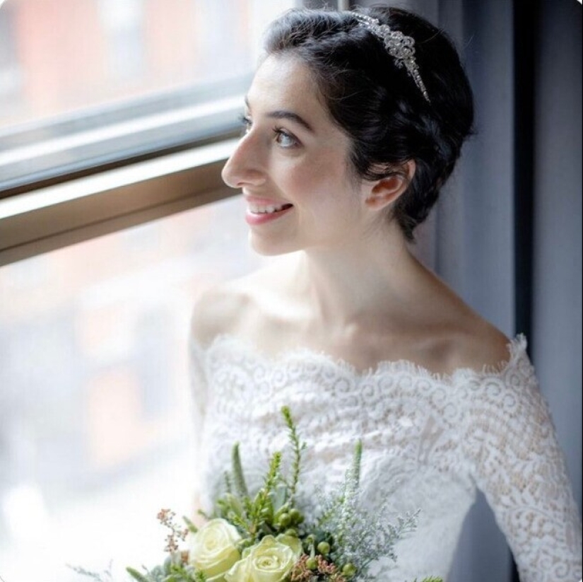 Proud profile: 30 imperfect but unique female noses