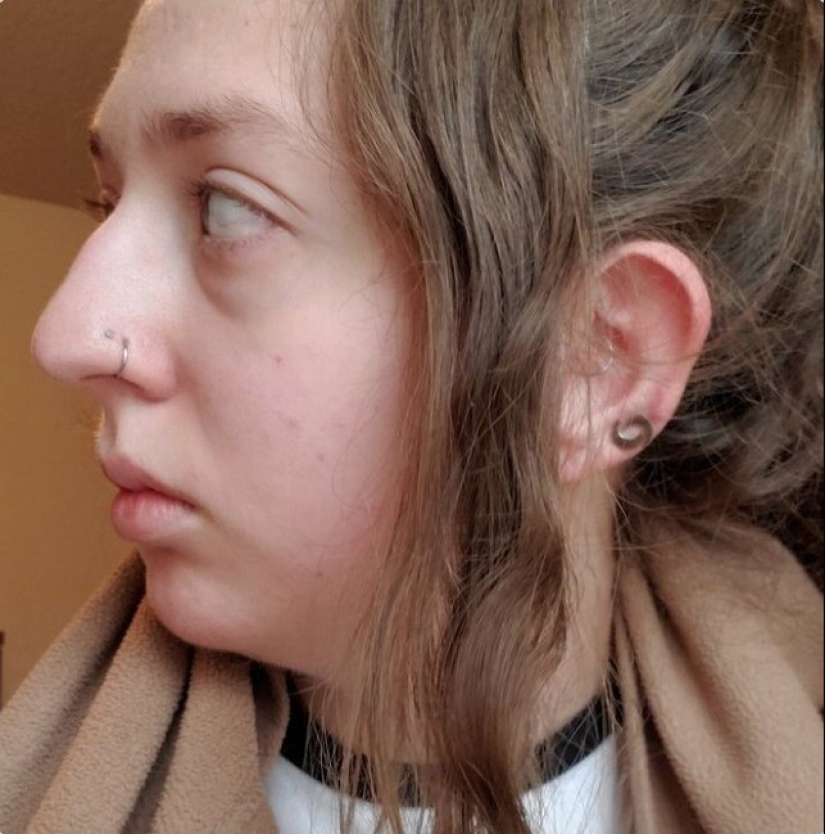 Proud profile: 30 imperfect but unique female noses