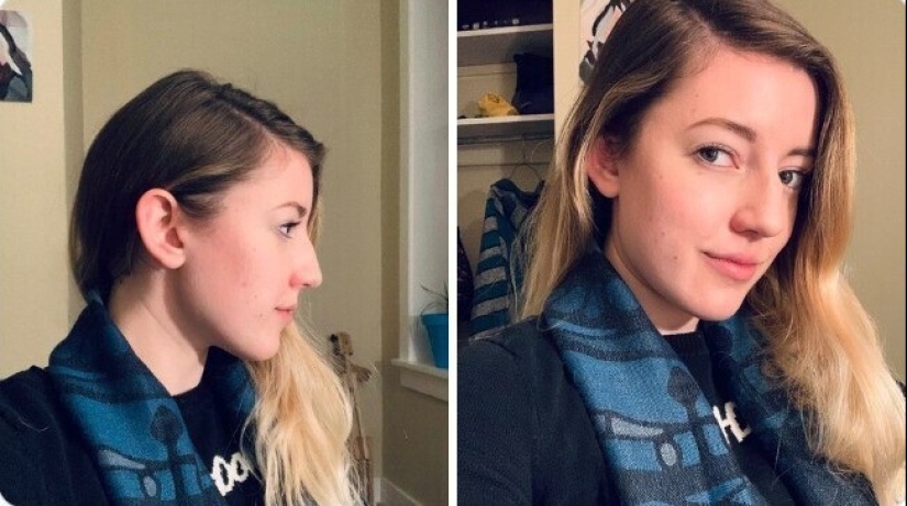 Proud profile: 30 imperfect but unique female noses