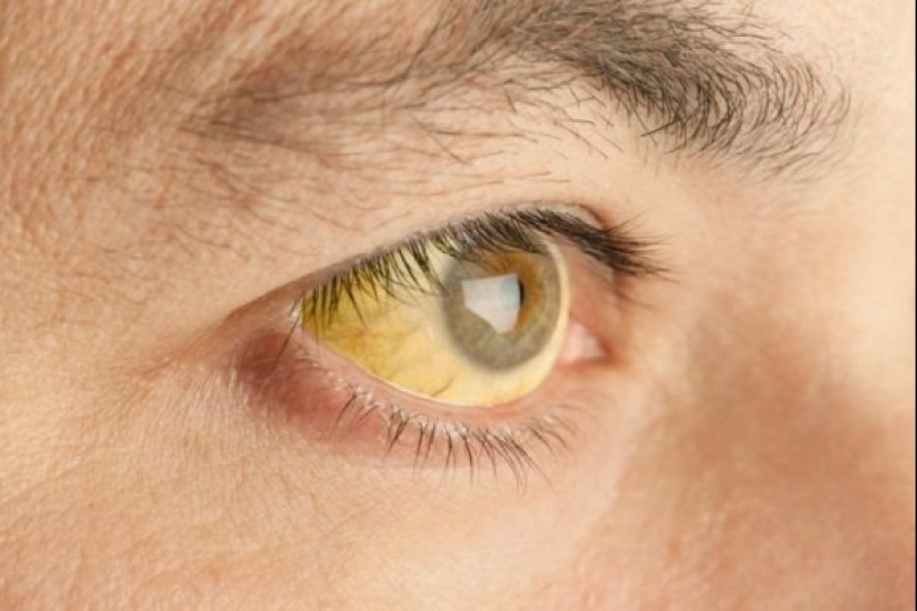 ¡Qué descanso! Enfermedades peligrosas que puedes contraer en el extranjero