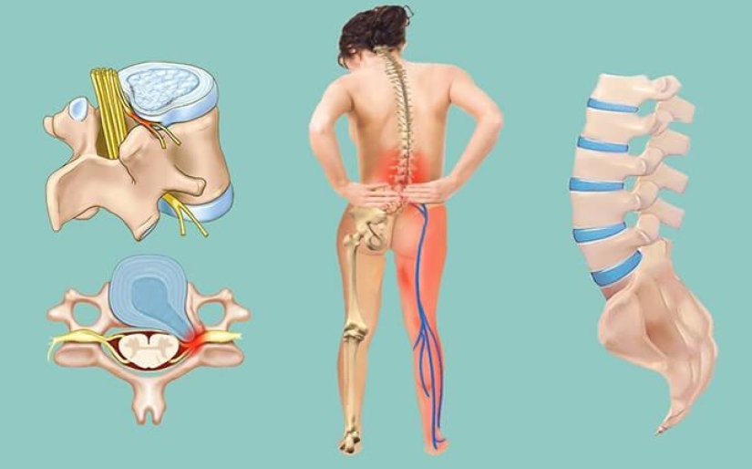 ¿Qué es la "deuda de dolor" Ko Matsudaira, o de Cómo quitar el malestar en la parte de atrás de 3 segundos