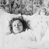 Radhika and Dudika Neik: The tragic fate of conjoined twins who were unfortunately separated