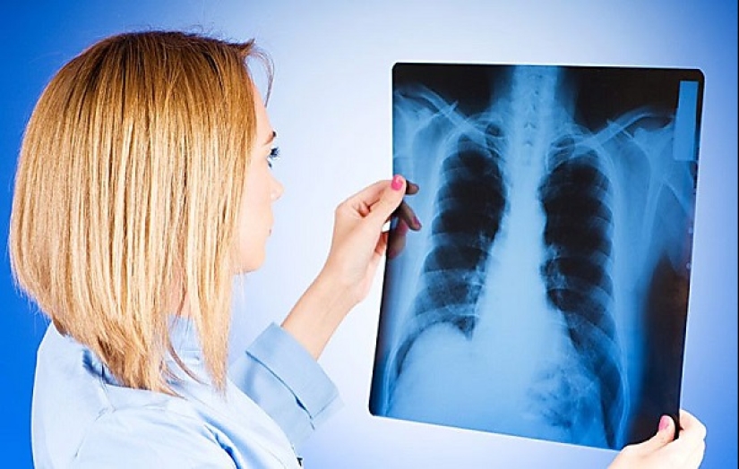 Sanciones de las autoridades de la ciudad contra las palomas: con qué molestó a la gente el ave del mundo Sanciones de las autoridades de la ciudad contra las palomas: con qué molestó a la gente el ave del mundo