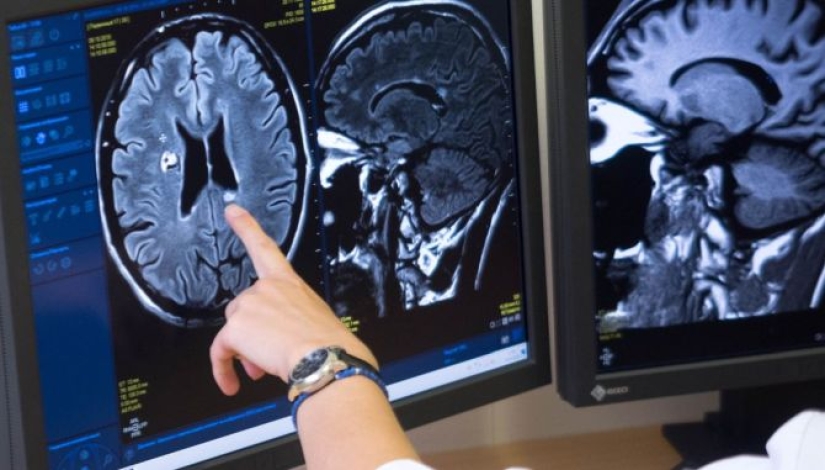 Síndrome del salón de belleza: por qué una visita a una barbería puede provocar un derrame cerebral Síndrome del salón de belleza: por qué una visita a una barbería puede provocar un derrame cerebral