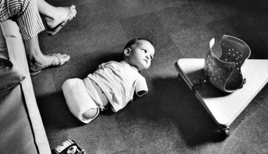 Talidomida tragedy, or As a "miracle pill" to destroy the bodies and lives of people