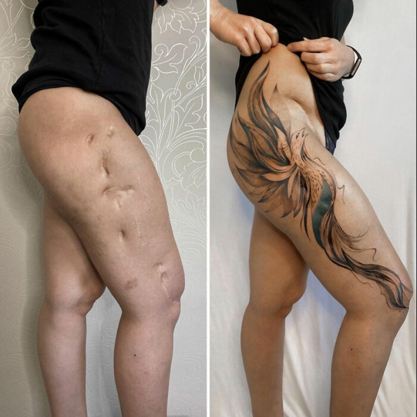 Tattoo Artist Covers Scars With Delicate Designs, And Here Are Her 10 Best Transformations