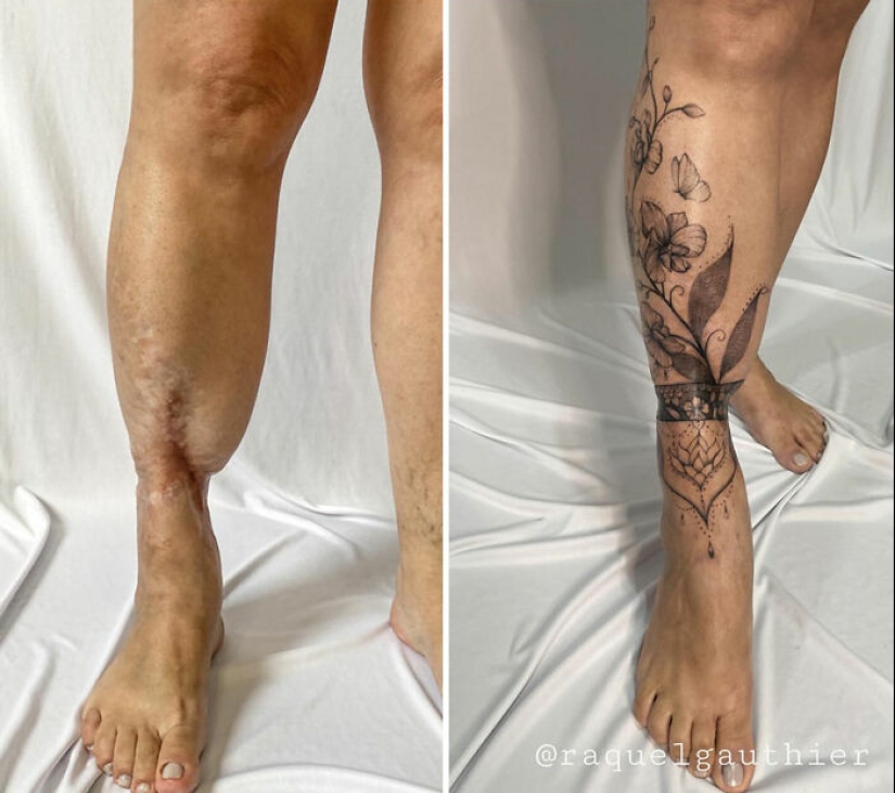 Tattoo Artist Covers Scars With Delicate Designs, And Here Are Her 10 Best Transformations