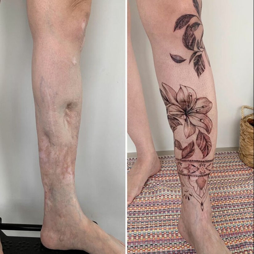 Tattoo Artist Covers Scars With Delicate Designs, And Here Are Her 10 Best Transformations
