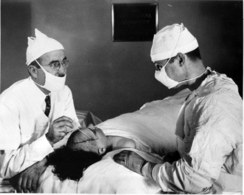 Terrible "medicina" de riñas y ninfomanía: Top 10 datos escalofriantes sobre las lobotomías