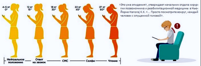 Text neck syndrome: what is dangerous and how to get rid of it