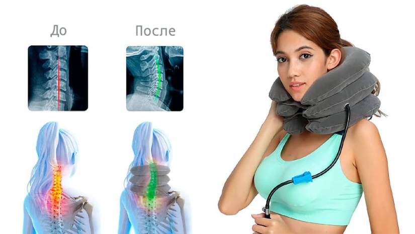 Text neck syndrome: what is dangerous and how to get rid of it