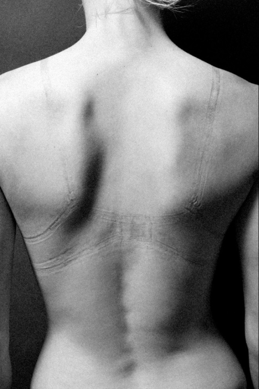 That's what lies behind the feminine splendor. It's even painful to look at these photos That's what lies behind the feminine splendor. It's even painful to look at these photos