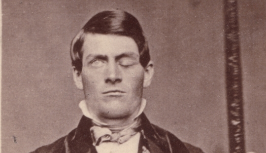 The Amazing story of Josephine Myrtle Corbin, a four—legged woman from Texas