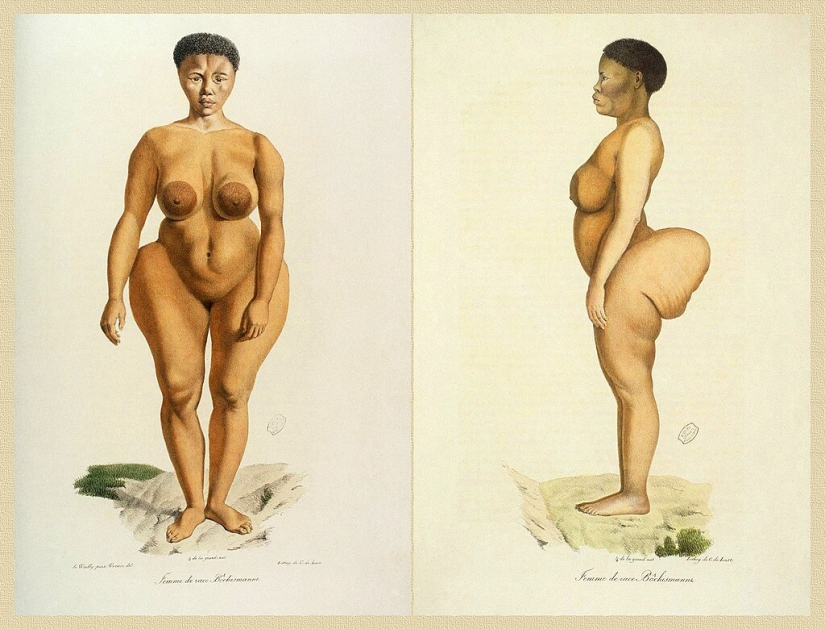 The Black Venus Story: The Tragic Fate of "Exhibit Man" Saartjie Baartman