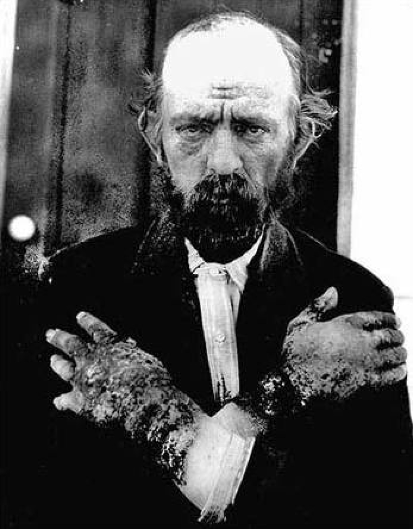 The Evil Spirit of Corn: How an Ancient Indian Curse Continues to Kill Europeans