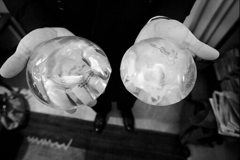 The fate of Timmie Jean Lindsay, the first woman to have breast augmentation