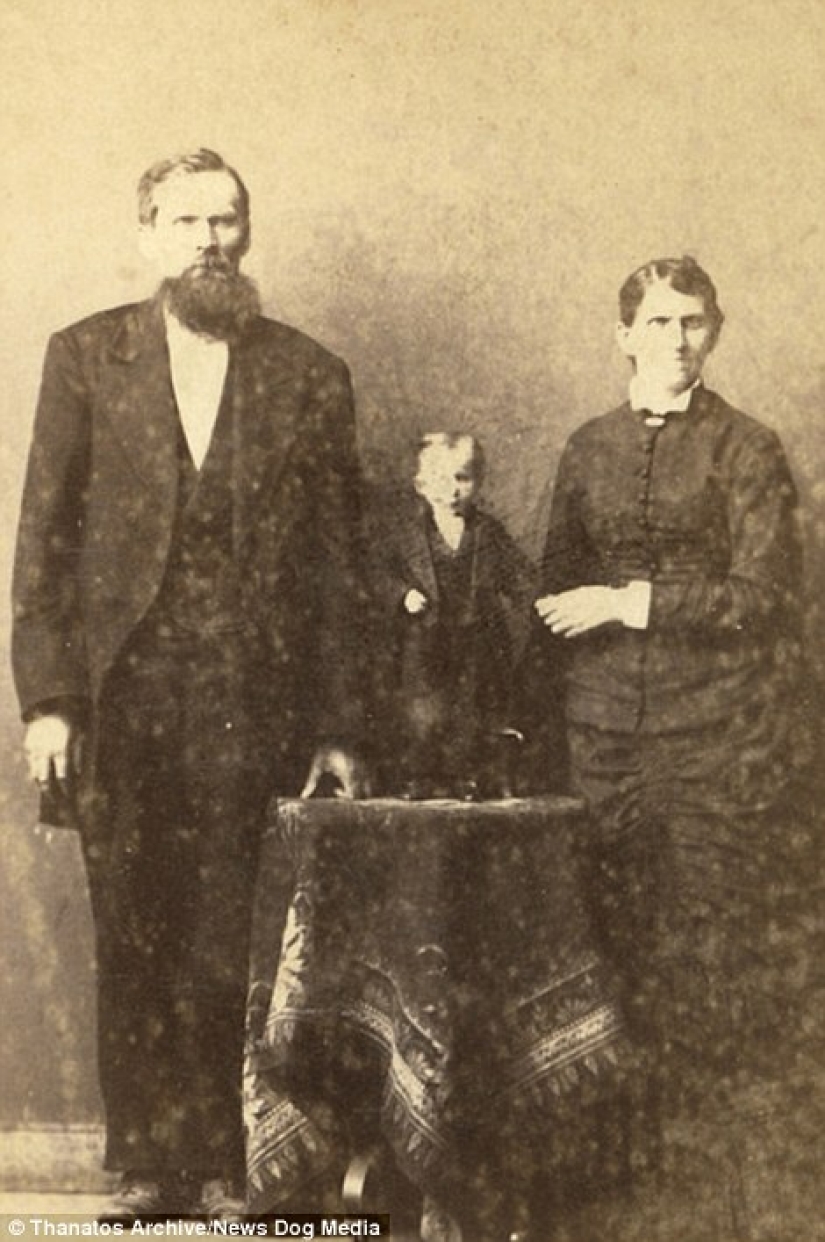 The harsh 19th century: a collection of archival photographs of people with deformities