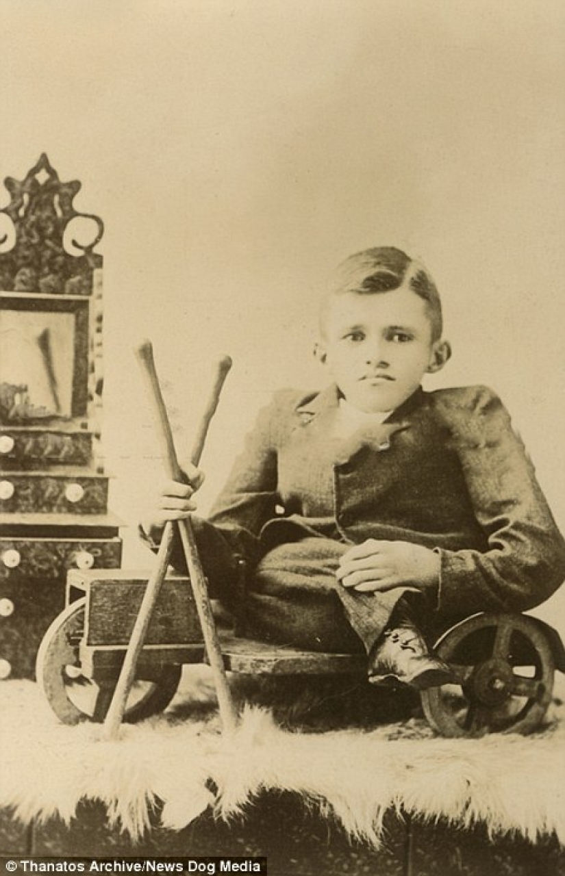 The harsh 19th century: a collection of archival photographs of people with deformities