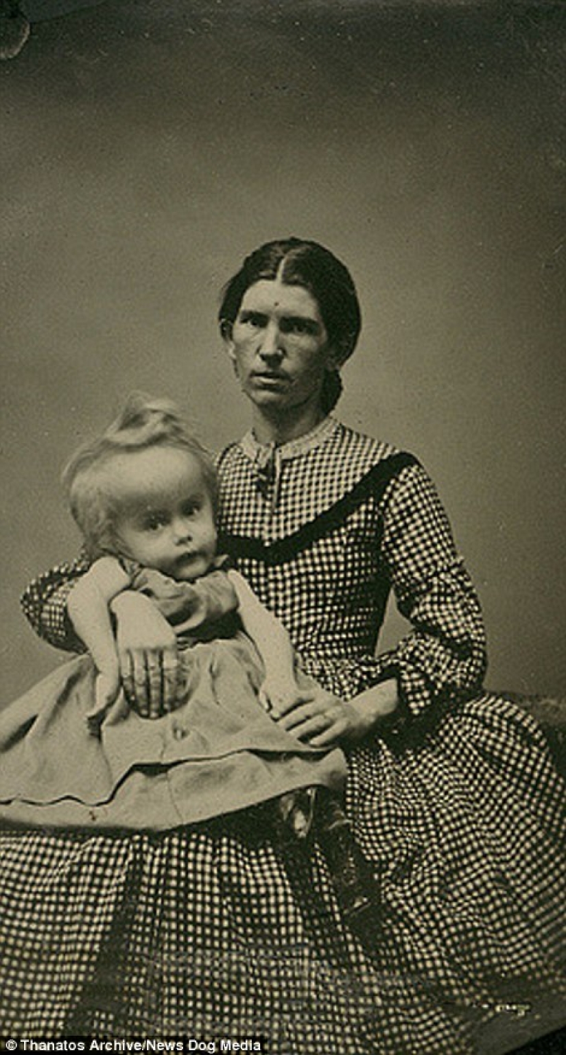 The harsh 19th century: a collection of archival photographs of people with deformities