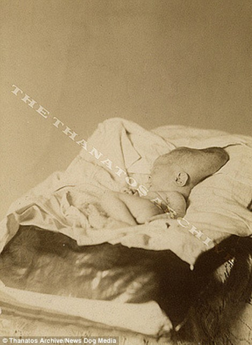 The harsh 19th century: a collection of archival photographs of people with deformities