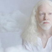 The hypnotic beauty of albinos in the photo project of Yulia Taits