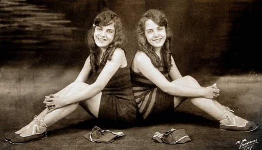 The life of Siamese twins Daisy and Violet Hilton The life of Siamese twins Daisy and Violet Hilton