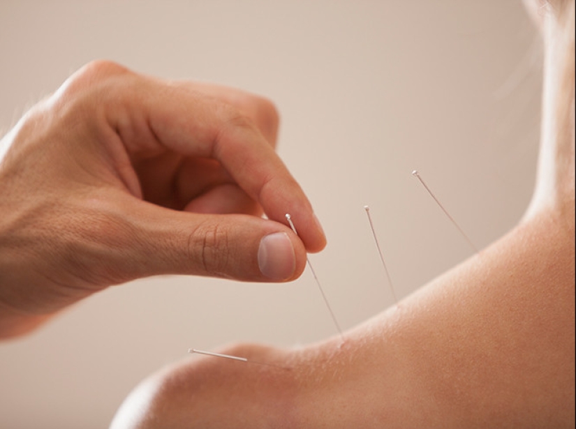 The myths and truth about Chinese medicine