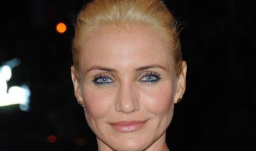 The rarest eye color in the world The rarest eye color in the world