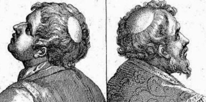 The secret of the Tonsure: why Catholic monks shaved the top of their heads The secret of the Tonsure: why Catholic monks shaved the top of their heads