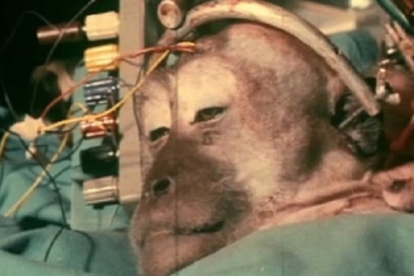 The story of a head transplant that was never meant to happen The story of a head transplant that was never meant to happen