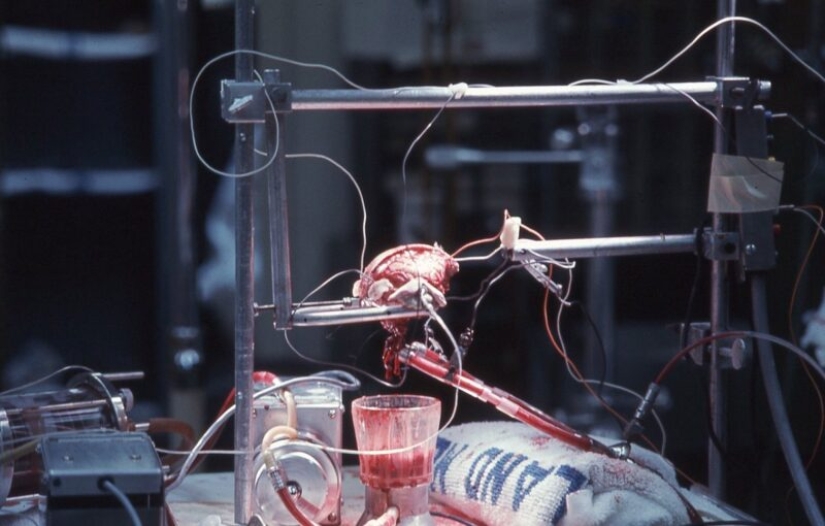 The story of a head transplant that was never meant to happen The story of a head transplant that was never meant to happen