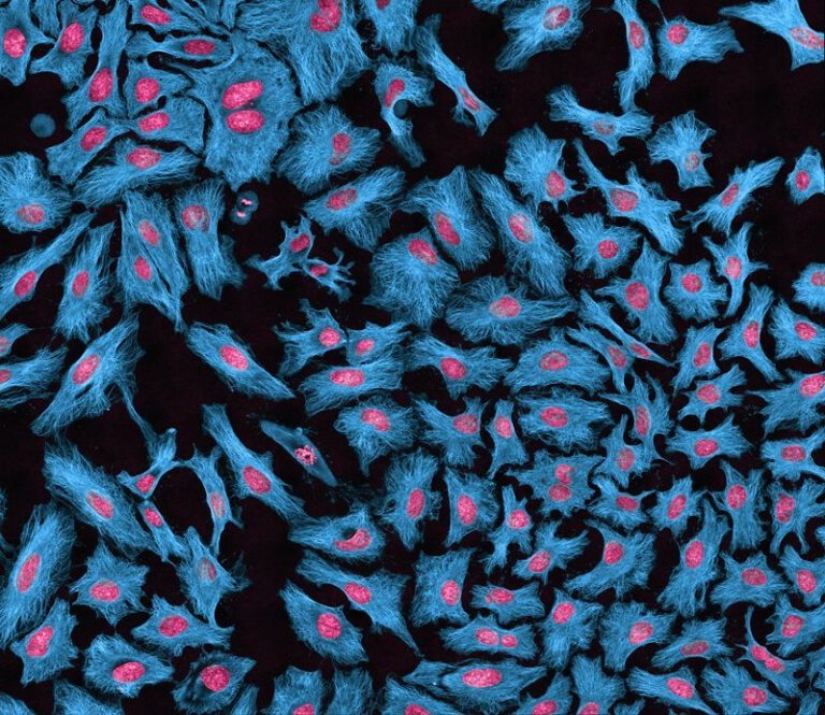 The story of Henrietta Lacks, the woman who revolutionized world science after her death